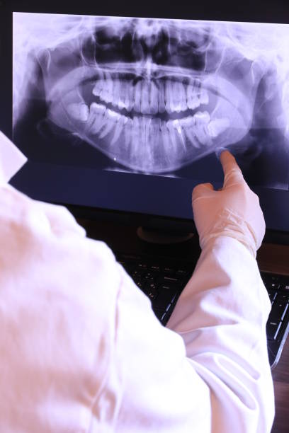 Best Knocked-Out Tooth (Avulsed Tooth) Treatment in Wintersville, OH