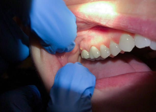 Best Walk-In Emergency Dental Services in Wintersville, OH