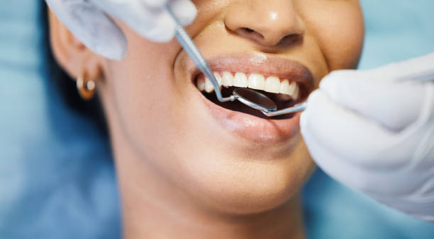 Best Emergency Dental Care for Sports Injuries in Wintersville, OH